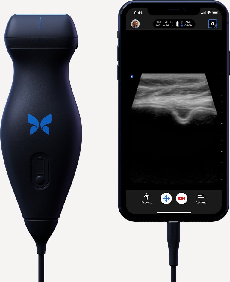 Ultrasound Machines