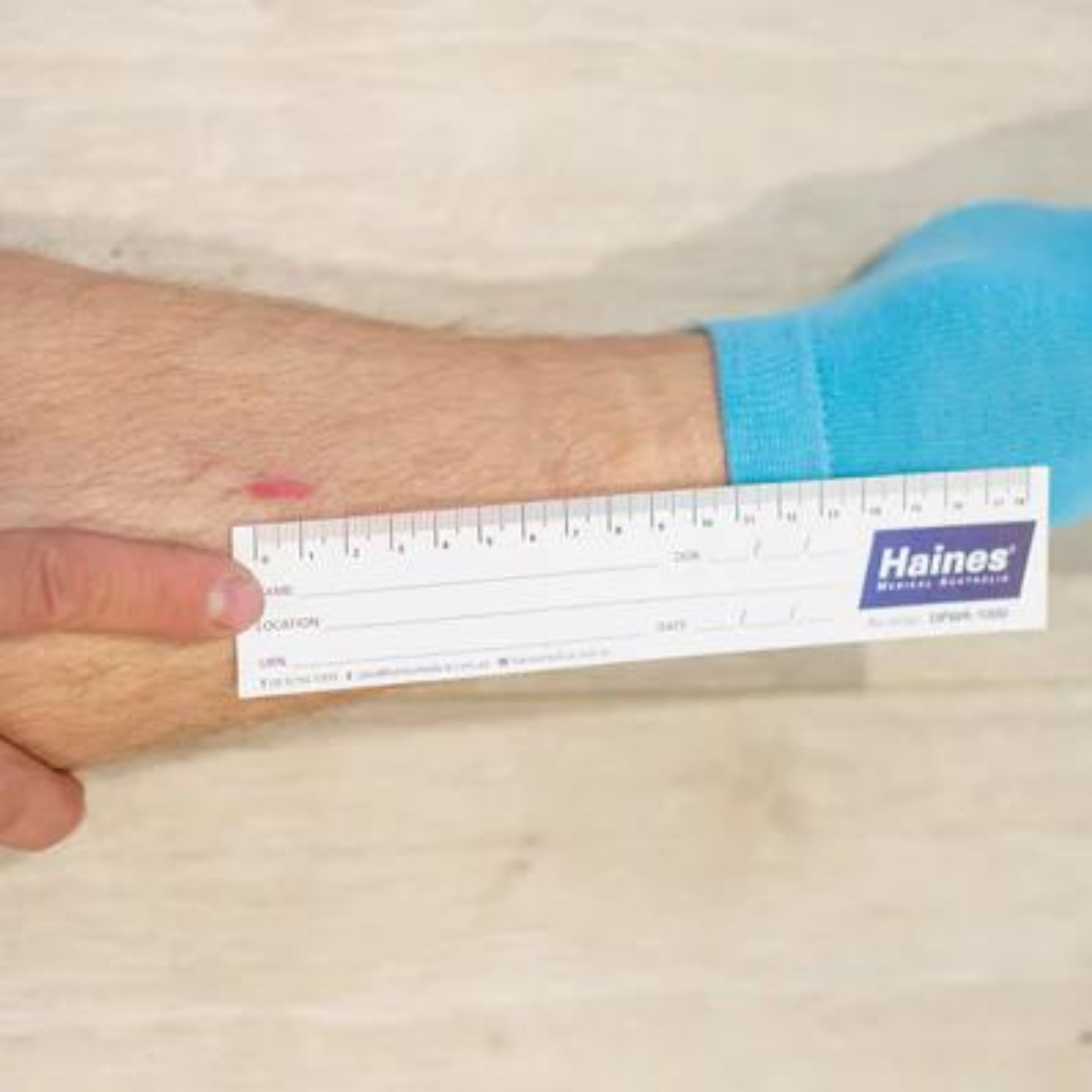 11x18 Paper With Ruler Paper Wound Ruler 18cm | QureMed