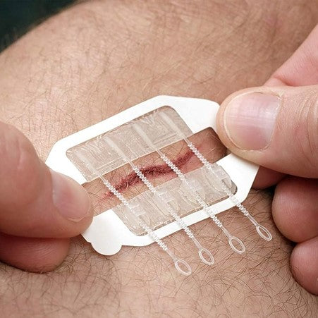 ZipStitch Medical Skin Closure Kit 6cm